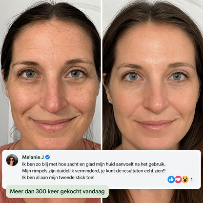 Collavia Lift Stick